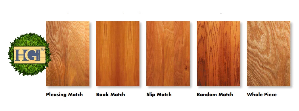 Veneer Matching.webp